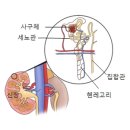 신증후군 이미지