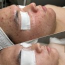 반포정 | 반포 피부관리 후기ㅣ진정해도 다시 붉어지는 홍조 피부?!