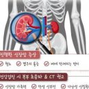 신장암 초기 증상 3가지 소변혈뇨 옆구리통증 느껴진다면 이미지