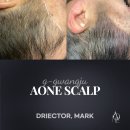 에이원헤어라인 이미지