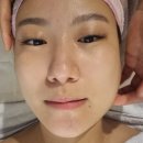 만수동피부관리 윤곽관리 후기 퀸즈스킨&바디