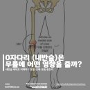 WITH MOON PT(트레이닝센터) | 내반슬(O자형 다리) 심층 분석 및 무릎 관절 보호 전략 [춘천PTㅣ엘알엠트레이닝]