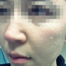 줌마 이벤트 ☆ 장희빈미안법 으로 피부미인 거듭나고 싶은 10분 모셔요 ♩