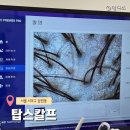 제트탑 | 신사두피관리 탑스칼프 서초점 체계적인 두피관리 만족 후기