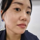 3공단2로2L-17 | 어떻게 지나갔는지 모르겠는 일상기록 잘지내다가 두손병원 화상진료 후기
