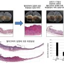 오메가-3, 크론병·위암·대장암 등 억제효과 이미지