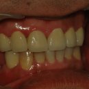 민치아치과기공소 이미지