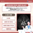 모야모야