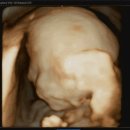 참여성병원 이미지