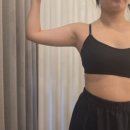 멍택시 | 팔뚝 지방흡입 당일 후기 : 지흡 전 준비물부터 5일차 통증 멍 붓기까지 솔직 정리!