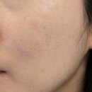 정선희 | 정선희 기미팩 내돈내산 솔직 후기