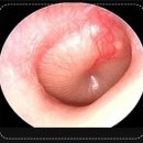 더원보청기 이미지