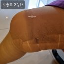 푸름외과의원 | 노원푸름외과 하지정맥류수술