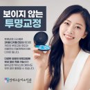 고운얼굴치과의원 | 구월동교정치과 유형에 따라 선택해야