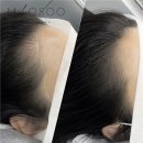 무수 | 자연스러운 결과가 만족스러웠던 여자두피문신, 강남두피문신 무수 청담 후기