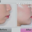 서울고운미소치과교정과치과의원 | 안양치과 서울고운미소치과교정과치과의원 서울대 박사 진료