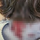 피투성이 된 뒤통수…경찰, 피 묻은 옷 등 증거 수집, 배현진 의원 “처벌 원해” 이미지