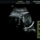 프라임여성의원 이미지