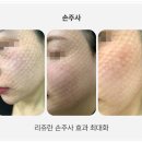 압구정튠의원 이미지