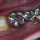 치과기공소 여름 이미지