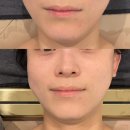 수인스킨케어 | 기장 피부관리 수인스킨 여름철 피부열응급케어 후기