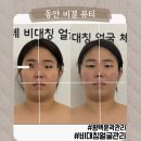 동안비결뷰티 | 평택 피부관리로 소문난 동안 비결 뷰티 평택 본점에 다녀온 후기!