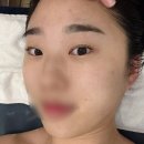 삼계풍림위너스타운 | 김해 삼계피부관리 빈스뷰티 세멘시트 관리 후기 - 모공·수분·탄력 케어