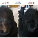 모자는 이제그만 (밀리언 사용후기)