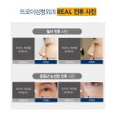 트로이성형외과 이미지