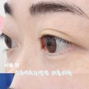 딥블랙 | 수유역속눈썹펌 유지력 좋은 러블리원 딥블랙펌 후기
