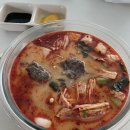 11650-16-114-14 | [임신 14주~16주차] 하이베베 첫 성공, 16주차 정기검진, 신경관결손 검사