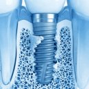 원메디랩 이미지