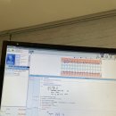 내돈내산 충치치료 1회차 시작 금인레이 가격