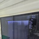 더편한마취통증의학과의원 | 연신내 정형외과 추천, 골프엘보 치료 초음파 주사 후기｜365더바른마취통증의학과의원