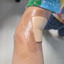 자극없는 드레싱 치료, 하이솝 이노테이프 사용 후기