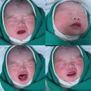 밥사랑 | 서울미즈병원 제왕절개 4박 5일 김영주 과장님 출산 후기 &amp; 아빠와 함께 목욕