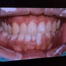 미푸른치과의원 이미지