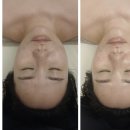 썬에스테틱 - 양산시 | [순천결혼준비] 순천 신대지구 에스테틱 <벨라썬> 윤곽관리 후기, 리프팅 효과에 피부관리 꿀팁까지!