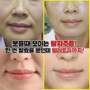 차스코 스네일 히알루론산 아이크림 한정수량 정리 이미지