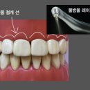연세청춘치과의원 | [분당] 수내역 과잉진료없는 치과 연세청춘치과의원