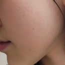케어슨헬스케어 | 세타필 시카세라 고요크림 올리브영에서 구매한 민감피부 장벽케어 후기
