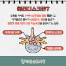 큰숲한의원 이미지