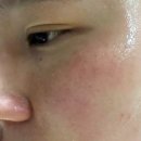 몽드로쉐 | 닥터크롬셀 마유 하이드로겔 벨벳 마스크! 저도 드디어 사용해보았어요
