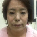 인셀덤 꿈