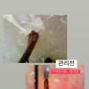 리뮤즈두피.탈모관리센터 네이버블로그