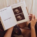 예산-35 | 35세 이상 임산부 의료비 지원사업 50만원 지원 받고 니프티검사 받은 후기