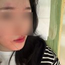 해달별연합한의원 | [대상포진 안면마비 1달만에 완치] 후유증 없이 치료한 새소식 들고왔읍니다 !