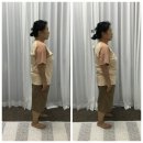 송윤숙상생약발 | 부천시청역마사지샵 송윤숙상생약발 체형교정 받은 후기