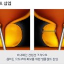 소문난비뇨의학과의원 이미지
