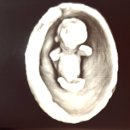 대서우체국 | [임신초기 9-15주차] 임밍아웃 | 초기정밀초음파 기형아검사 | 태교여행 꿀팁 | 임산부교통비지원 신청